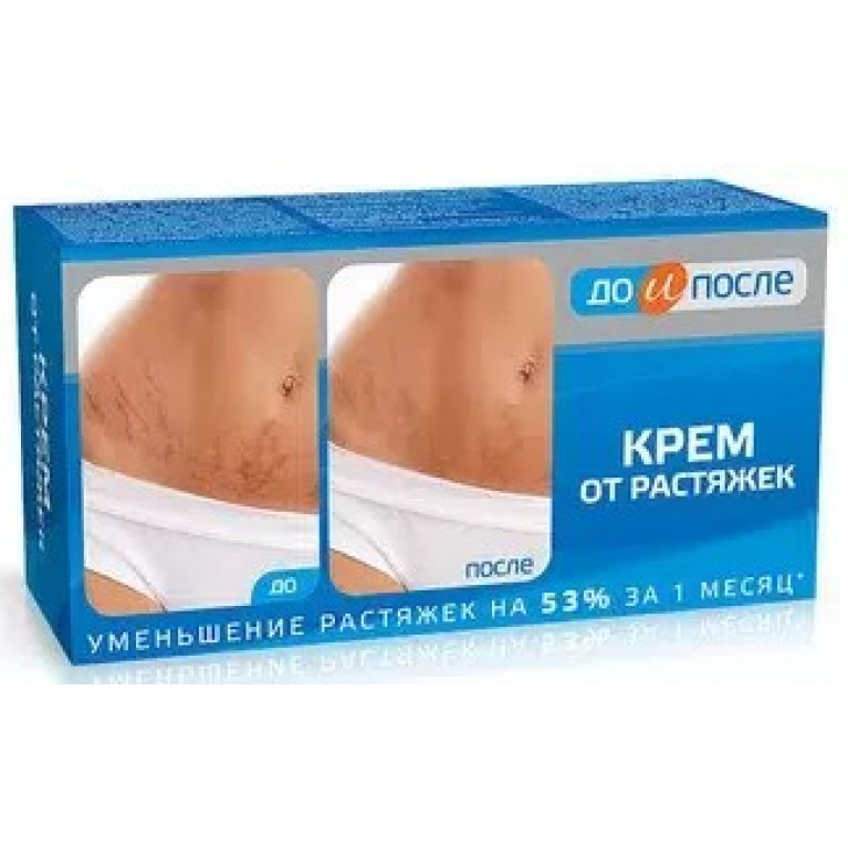 До и после крем от растяжек 100 мл