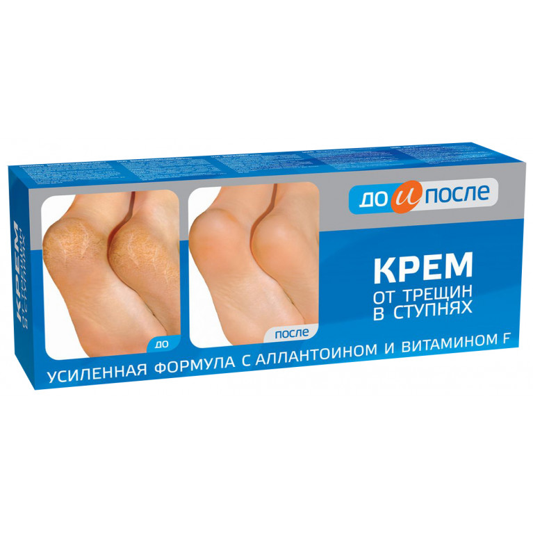 До и после крем для ног от трещин 50 мл