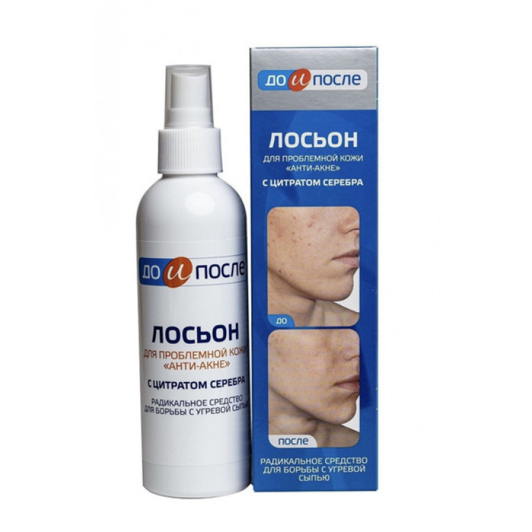 До и после лосьон с цитратом серебра 200 мл